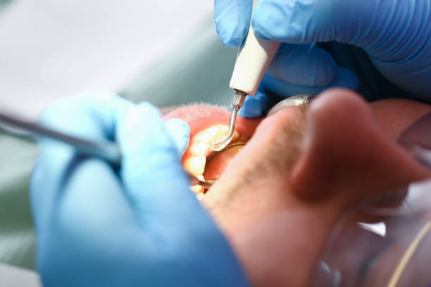 Best Pediatric Emergency Dentist in Lambertville, MI