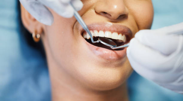 Best Emergency Dentist for Knocked-Out Tooth in Lambertville, MI