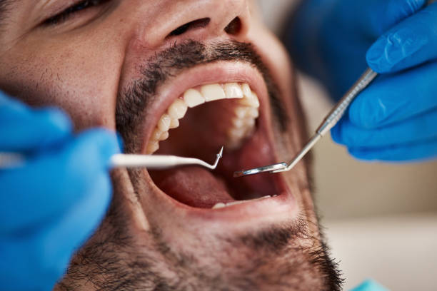 Best Urgent Dental Care for Toothache in Lambertville, MI